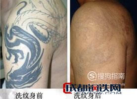 正文 上一篇 下一篇>01 清洗纹身有八种方法,第一种方法:中药除纹身